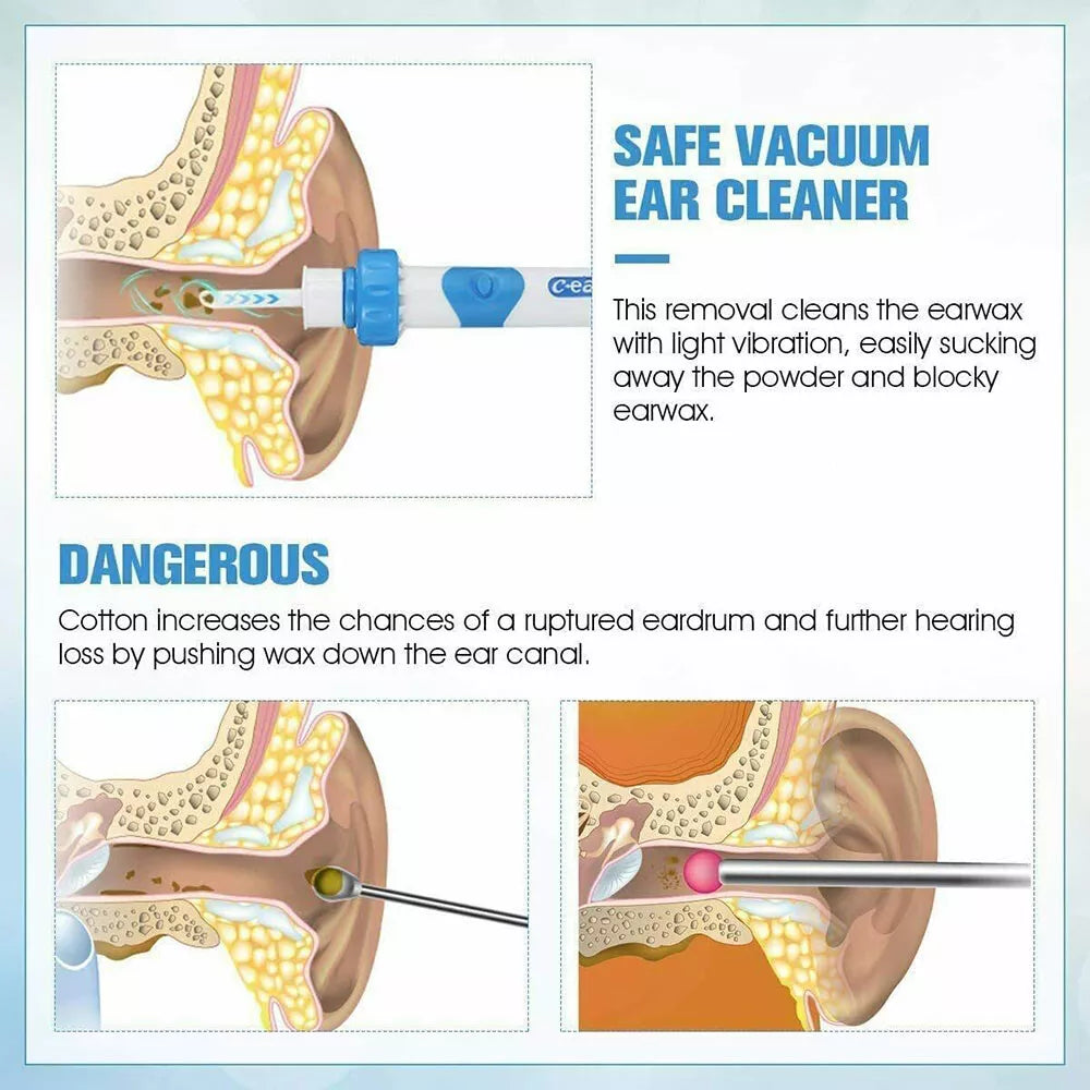 EarSavvyy
